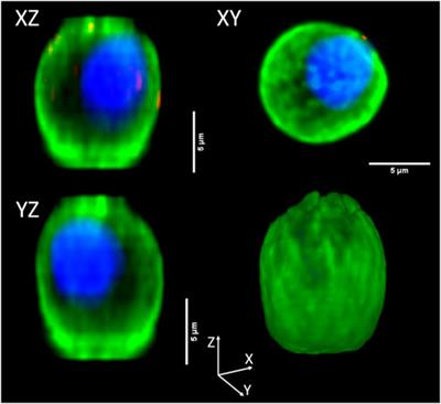 Human umbilical cord blood cells suffer major modification by fixatives and anticoagulants